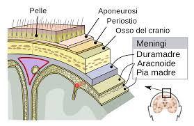 meningite